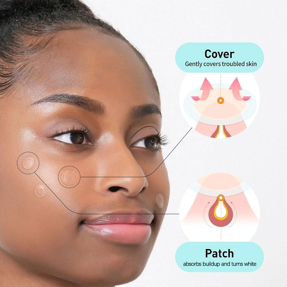 Olive Young Care Plus Spot Cov – Skincare Acne Bewertung und Preis