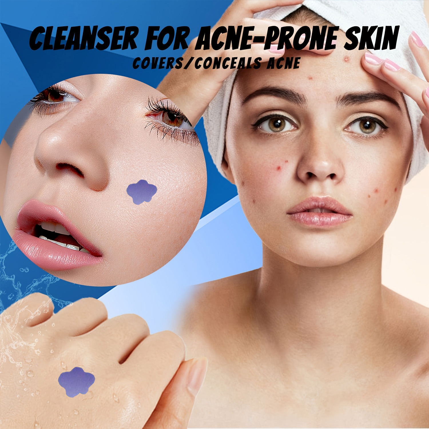 Mikronadel-Akne-Pflaster 232 S – Skincare Acne Bewertung und Preis