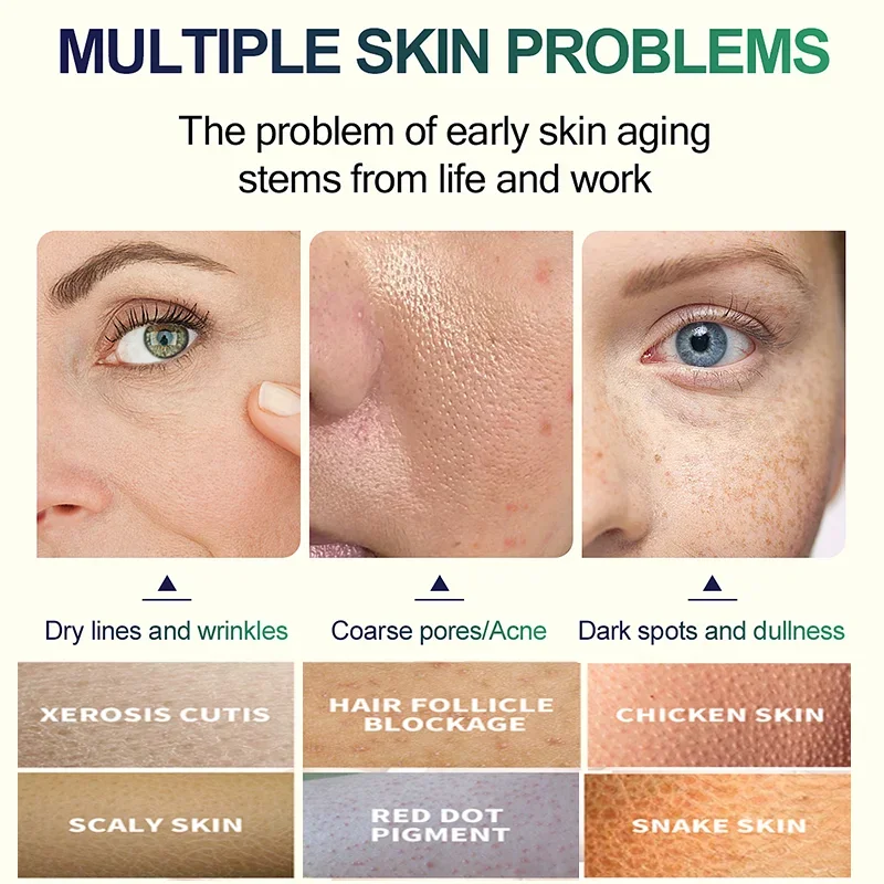 2. Salicylsäure Gesichtspeelin – Glycolic Acid Exfoliant Bewertung und Preis