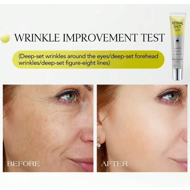 Retinal 0,1% Intensiv-Pantheno – The Ordinary Serum Hyaluronic Acid Bewertung und Preis