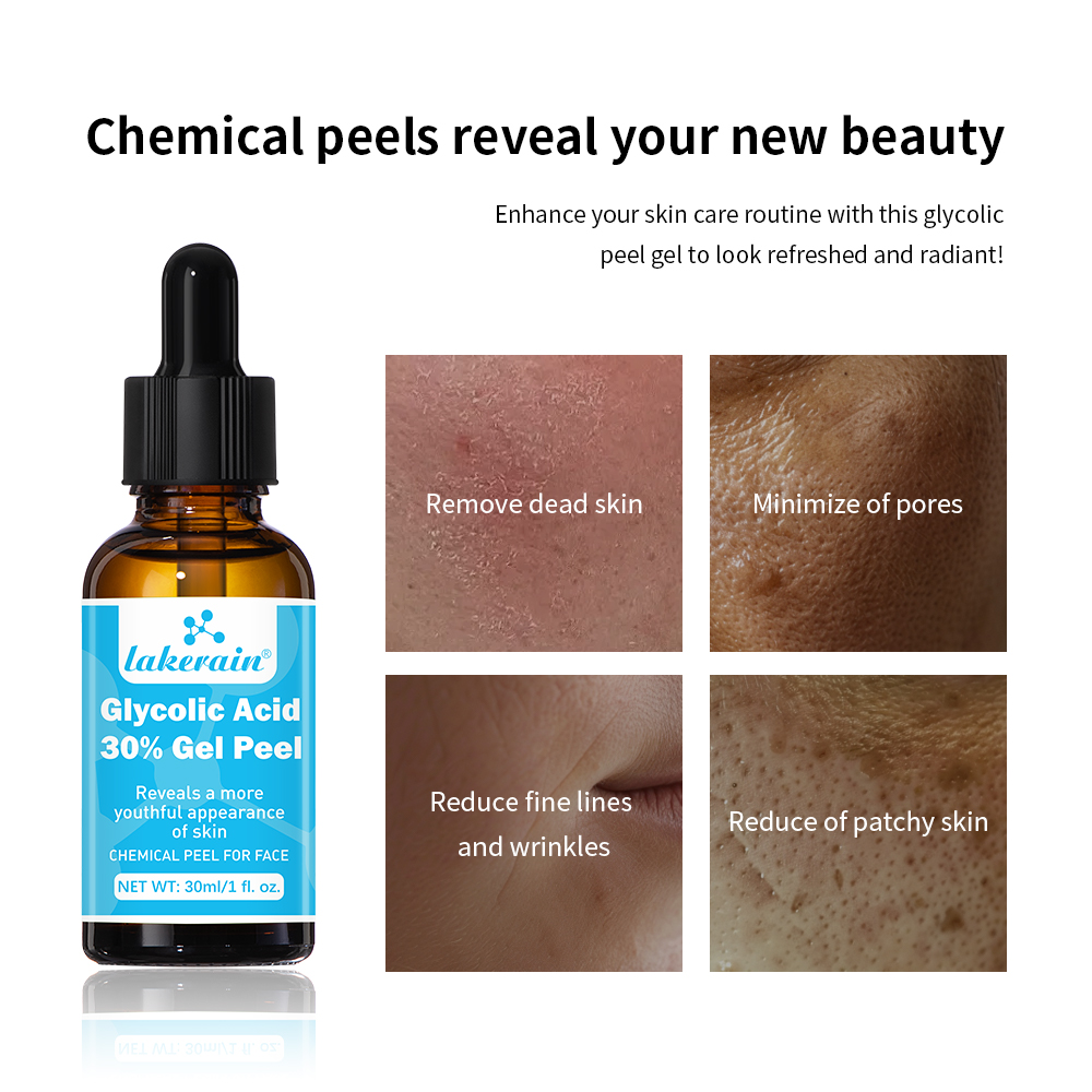 30 % Glykolsäure-Peeling-Gel,  – Glycolic Acid Exfoliant Bewertung und Preis