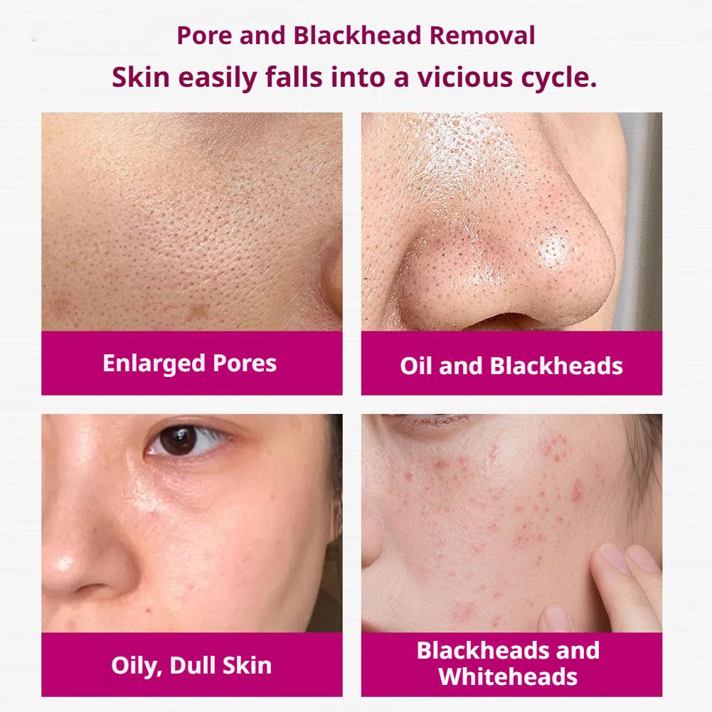 Salicylsäure-Serum zur Porenve – Glycolic Acid Exfoliant Bewertung und Preis