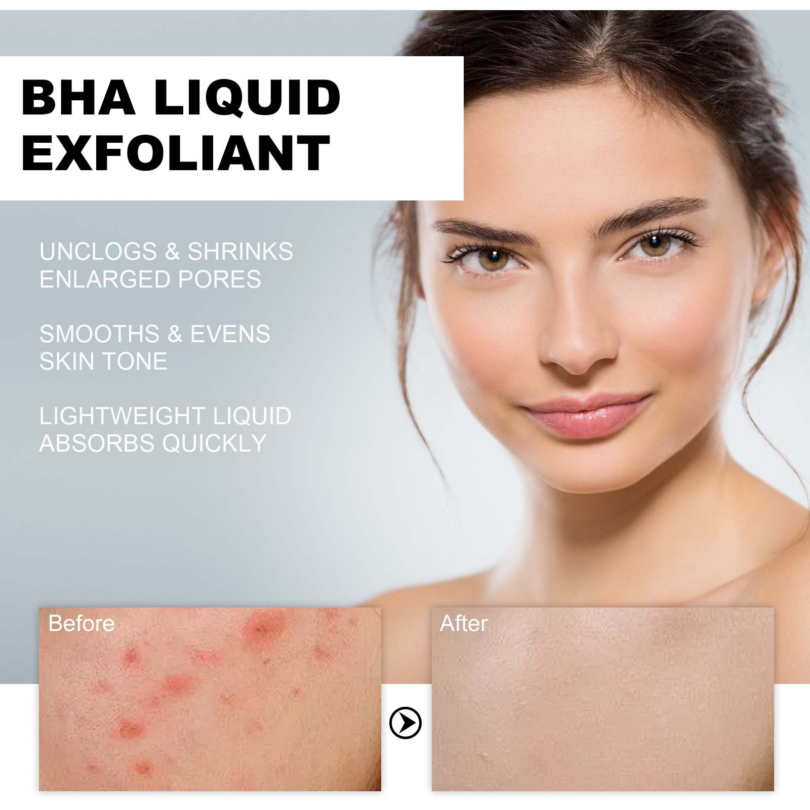 2% Salicylsäure Flüssiges Peel – Glycolic Acid Exfoliant Bewertung und Preis