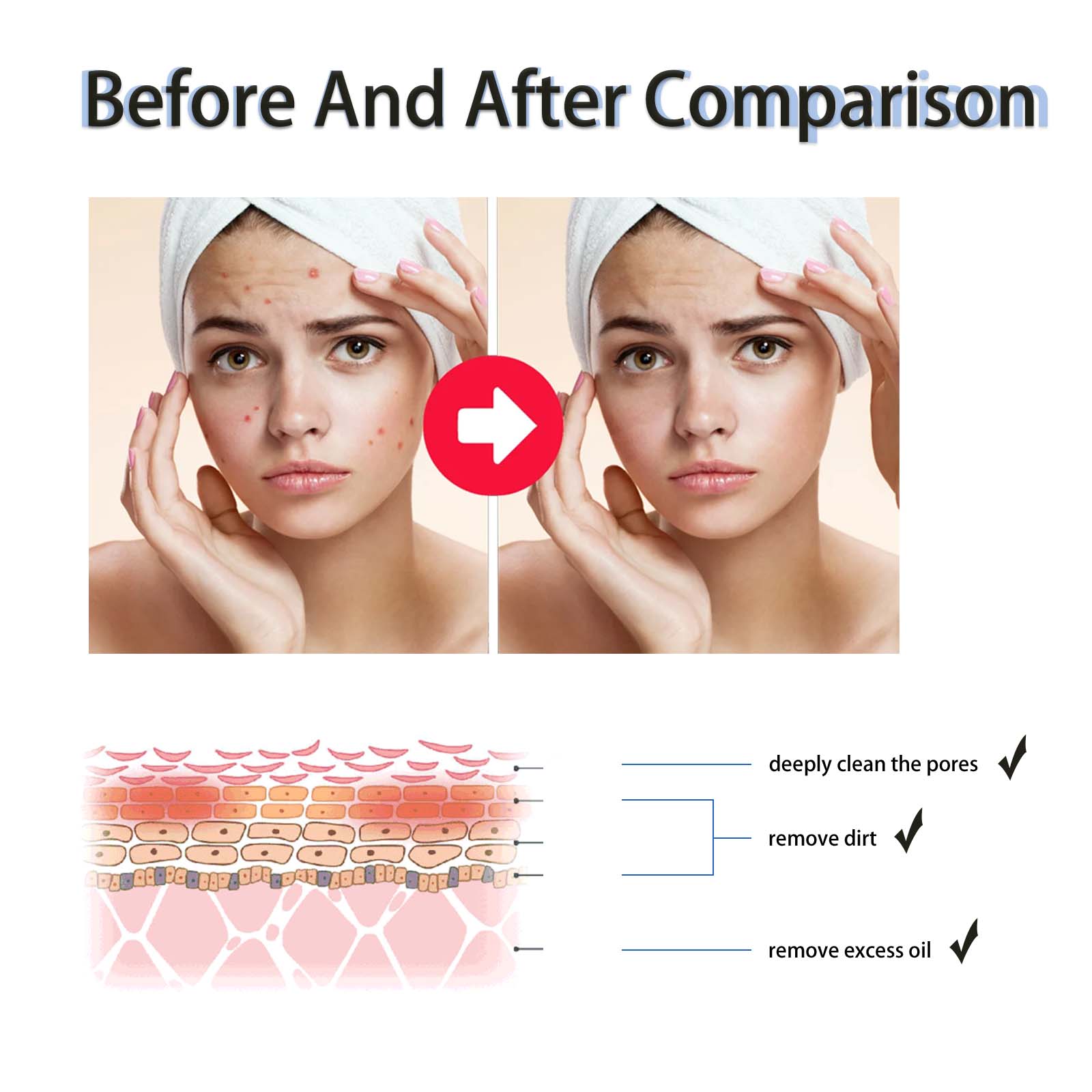 2% Salicylsäure Flüssiges Peel – Glycolic Acid Exfoliant Bewertung und Preis