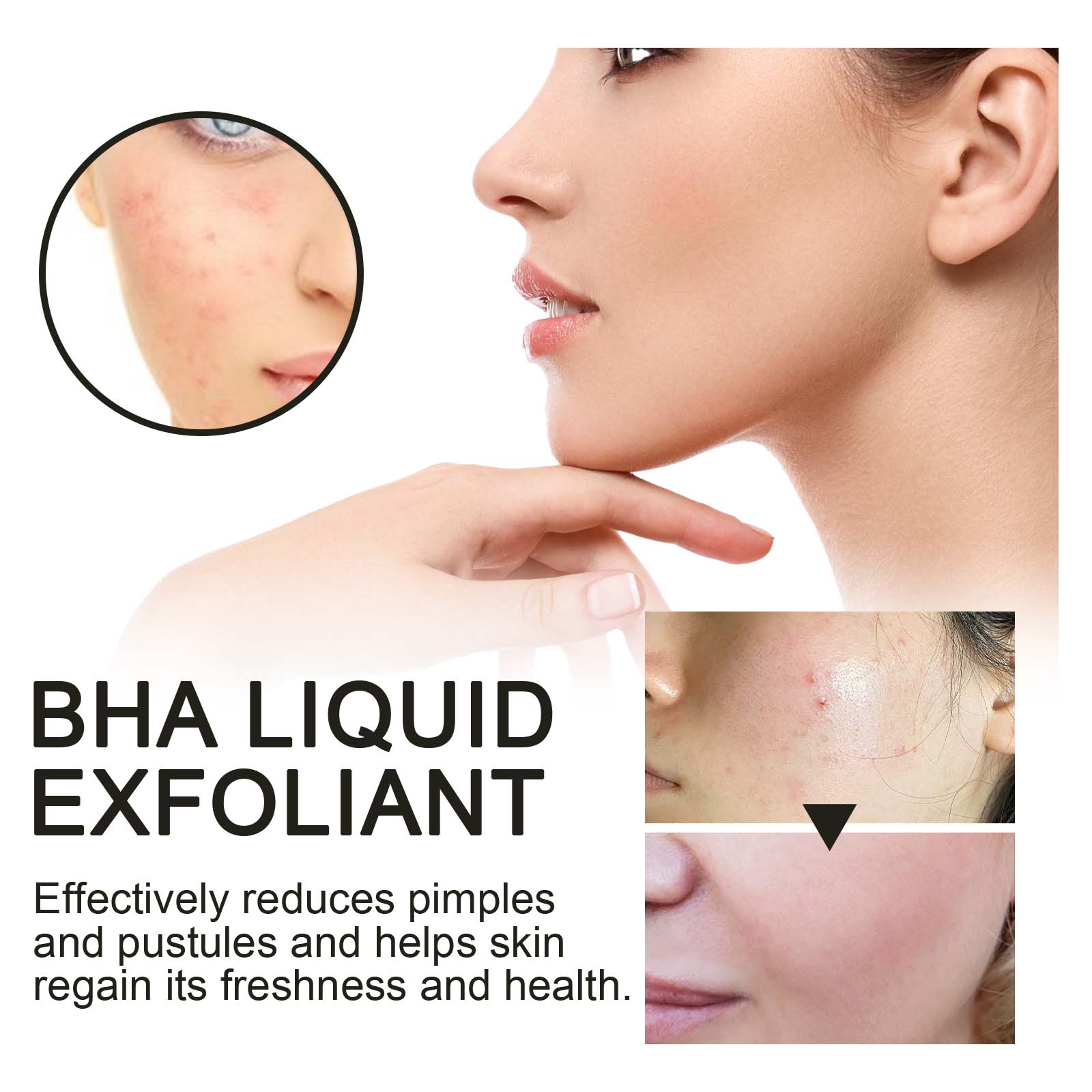 2% Salicylsäure Flüssiges Peel – Glycolic Acid Exfoliant Bewertung und Preis