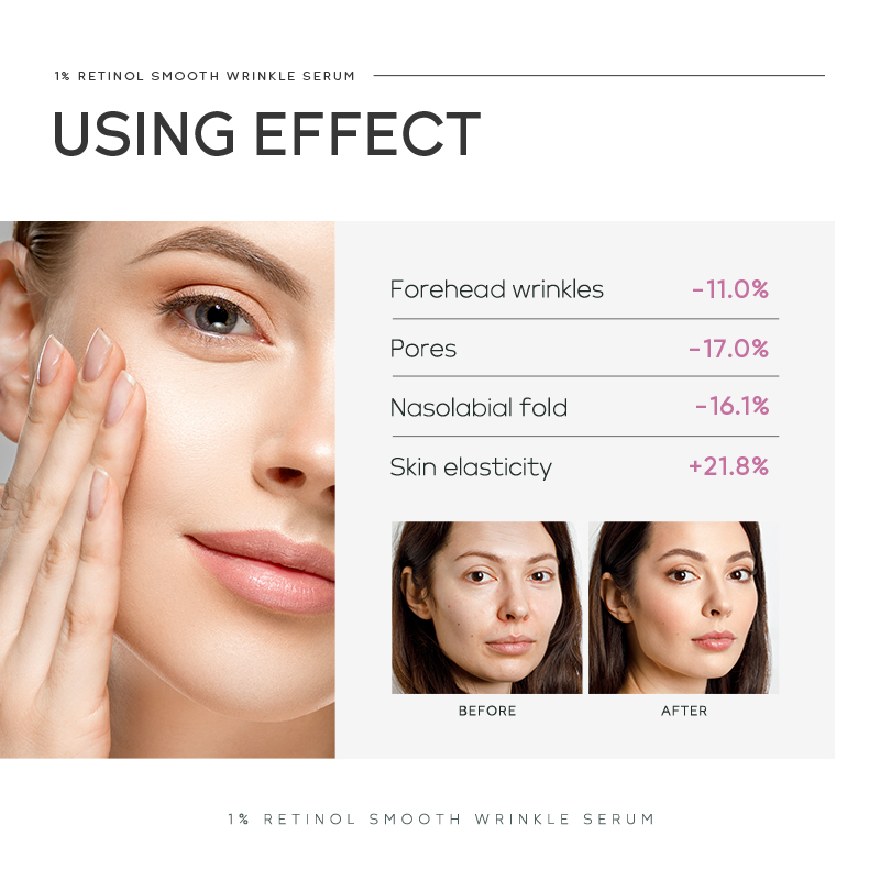 Quiyum 1% Retinol Anti-Falten- – The Ordinary Serum Hyaluronic Acid Bewertung und Preis
