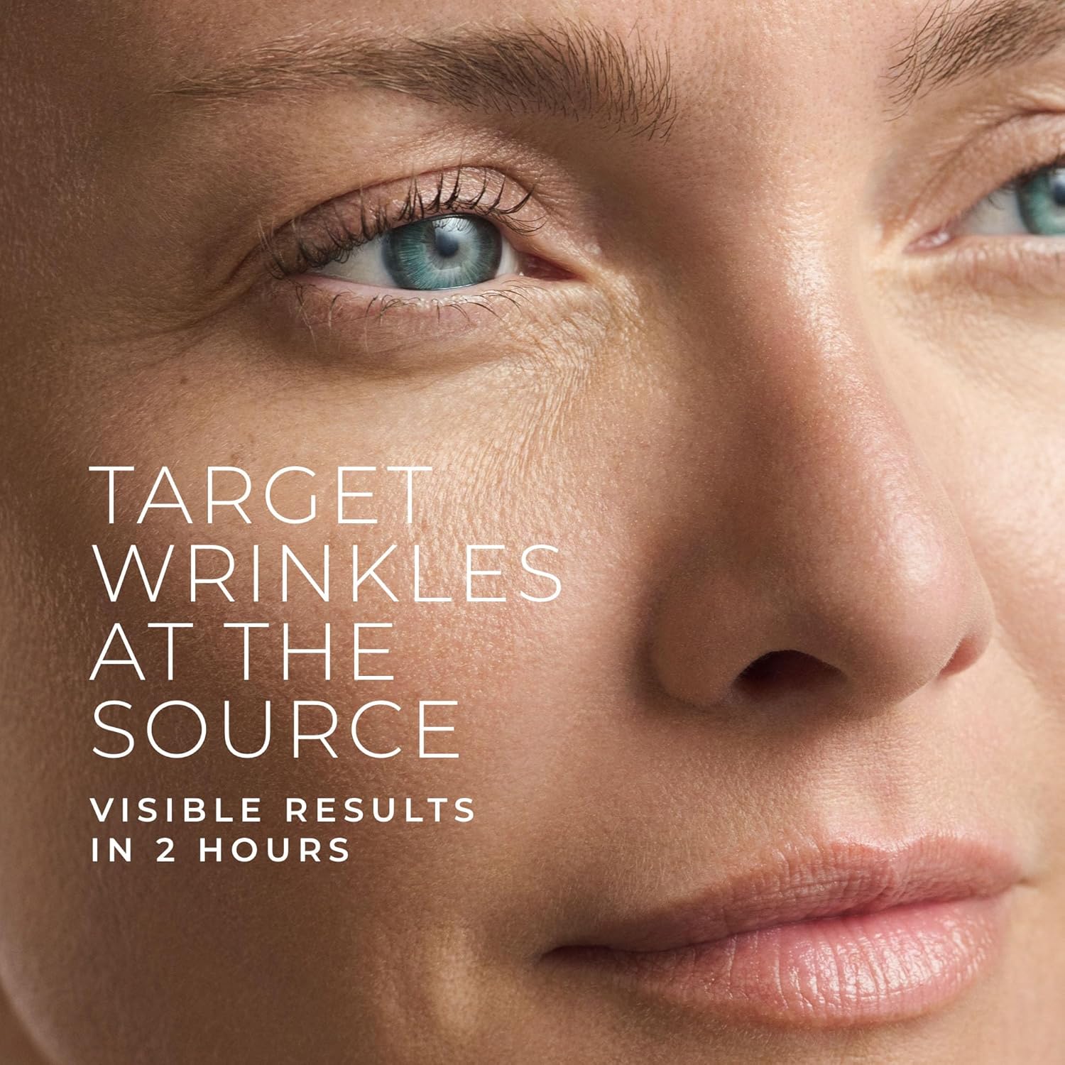 Hyaluronsäure-Retinol-Mikronad – Skincare Acne Bewertung und Preis
